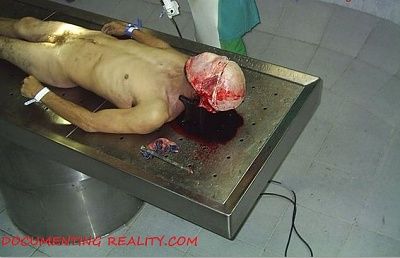 autopsy3.jpg