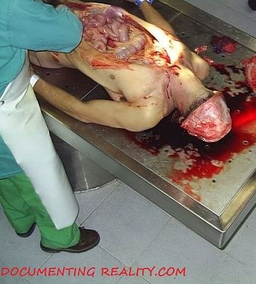 autopsy4.jpg