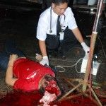 medic-checks-brainless-man-signs-life-02-150x150.jpg