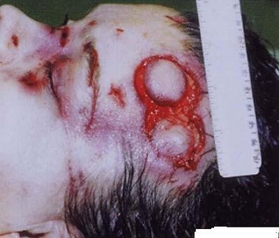 patho94.jpg