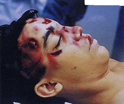 patho93.jpg