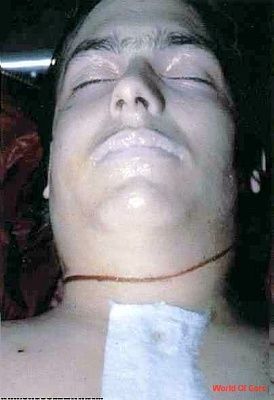 77949_dead-real012_123_216lo.jpg