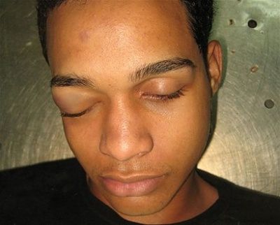 o-cadaver-de-los-5-hombres-asesinados-en-el-mirador-sur3.jpg