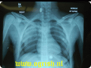 36f69211268541.gif