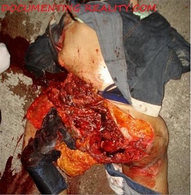 20533-woman-crushed-carbig1.jpg