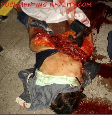 20533-woman-crushed-carbig2.jpg