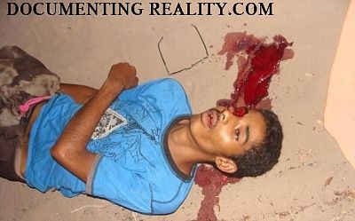 16272-teen-shot-directly-eyebig0.jpg