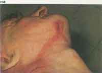 GAGreshamfig238p253thumb.jpg