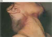 GAGreshamfig239p253thumb.jpg