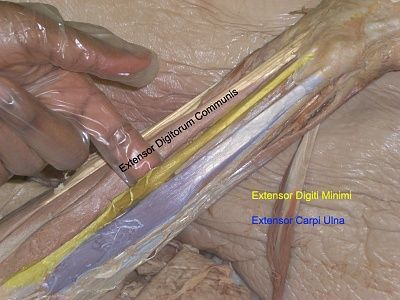 3-minimi-ex-carp-ulna.jpg