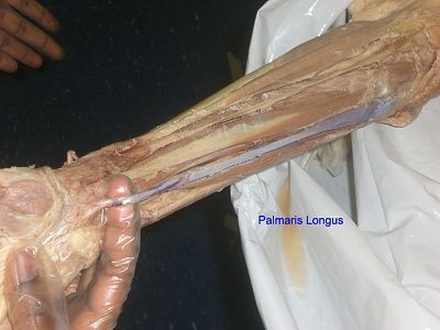 6-palmaris-longus.jpg