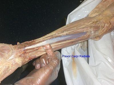 7-flexor-carpi-radialis.jpg