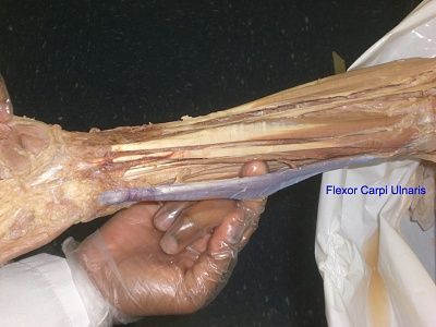 8-flexor-carpi-ulnaris.jpg