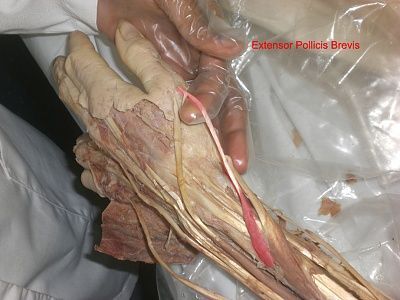 14-extensor-pollicis-brevis.jpg