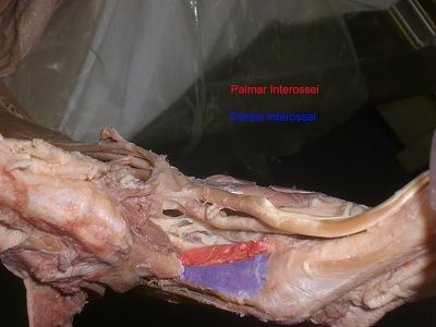20-palmar-dorasl-interossei.jpg
