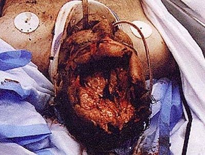 head6-2-.jpg