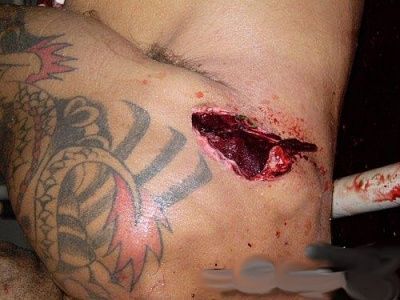 face-messed-up-gunshot-wounds-01-500x375.jpg