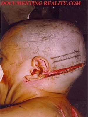 wound-inspection.jpg