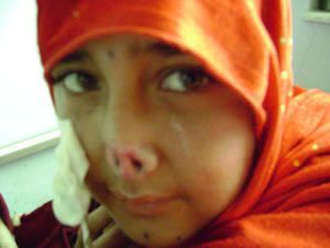nose.jpg