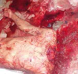 IRAQ beheaded bloody.jpg