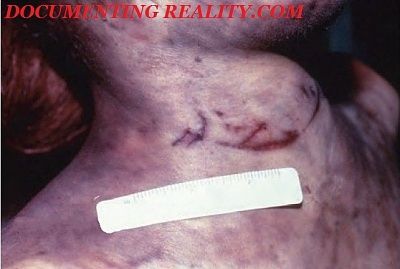 stabbed-herself3.jpg