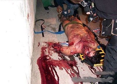 man-severed-arm-01.jpg