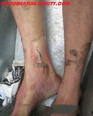 burnt-death5.jpg