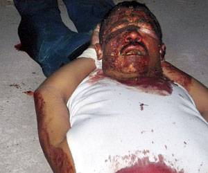 decapitado policia acapulco.jpg