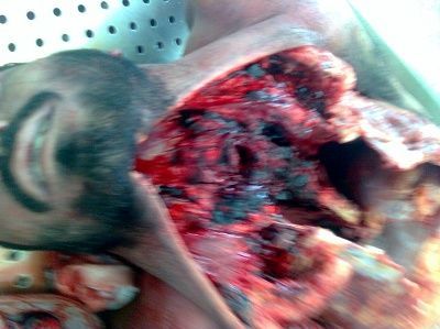 neck-trauma-after-wreck-www.cutedeadguys.net.jpg