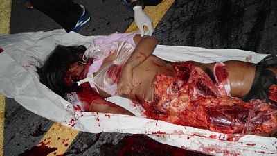 21215-woman-ran-over-all-thats-leftbig0.jpg
