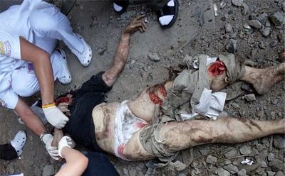 20681-two-woman-destroyed-motorcycle-accidentbig1.jpg
