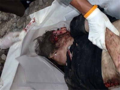 20681-two-woman-destroyed-motorcycle-accidentbig6.jpg