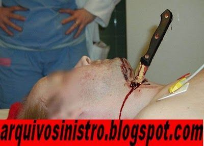 stabbed-neck-kitchen-knife.jpg
