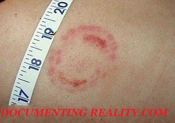 bite marks3.jpg