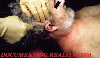 removing-brain.jpg