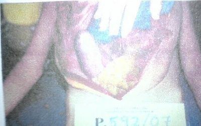 8-year-old-abused.jpg