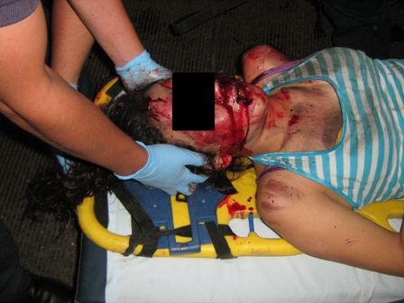 23_01_12_327_DOS_MUERTOS_EN_ACCIDENTE_GOMEZ_MORIN_Y_GABRIELA_MISTRAL.JPG
