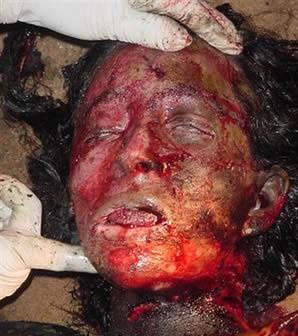 in_flames_burntwoman1-146c160.jpg