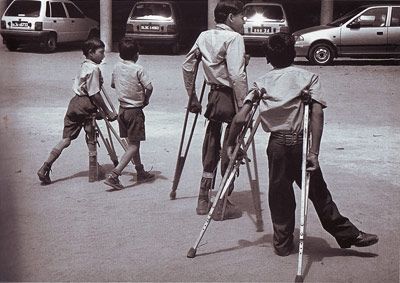 Polio_Paralysis.jpg