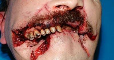 facial-gunshot.jpg