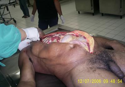 Autopsia-3.jpg
