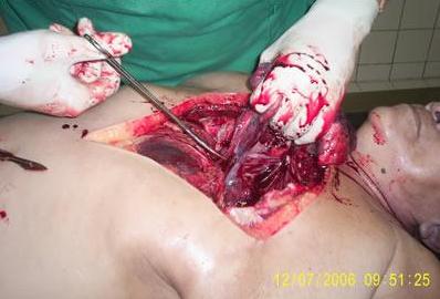 autopsia-7.jpg