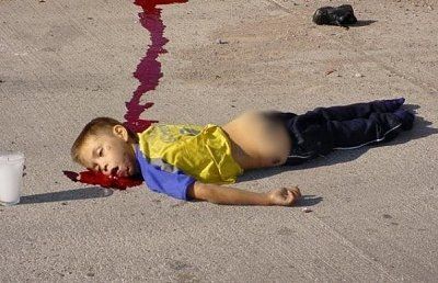 10-year-old-hit-car.jpg