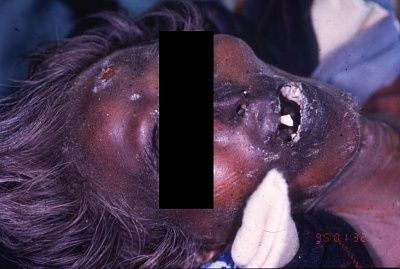 decomposed1.jpg