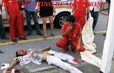 foot-torn-off1.jpg