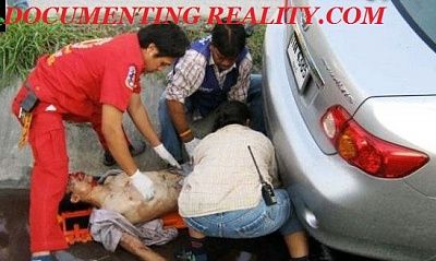 foot-torn-off2.jpg