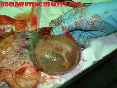 traffic-accident-baby-dead.jpg