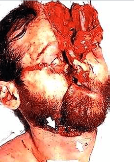 head splat1.PNG