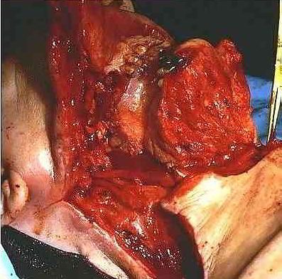 facial-slicing.jpg