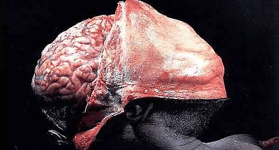 peeled-head.png